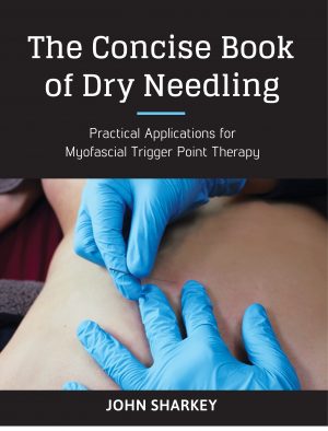 The Concise Book of Dry Needling