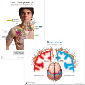 Homunculus and Thoracic Outlet Poster